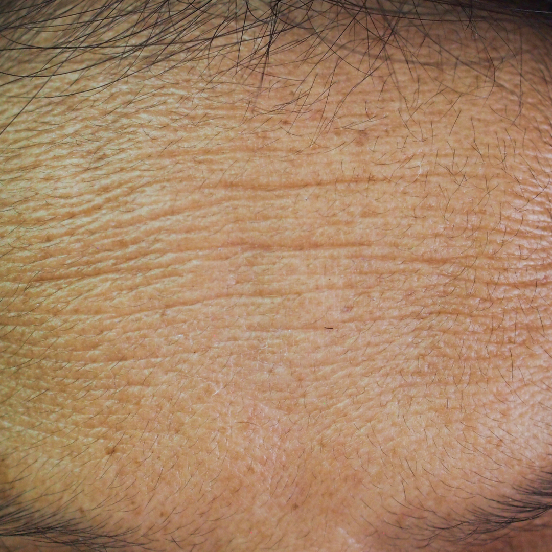 anti-aging